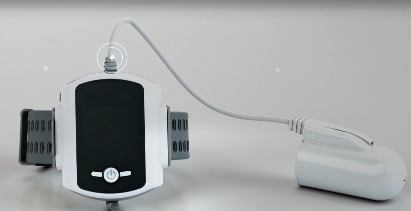 At-Home Sleep Apnea Test